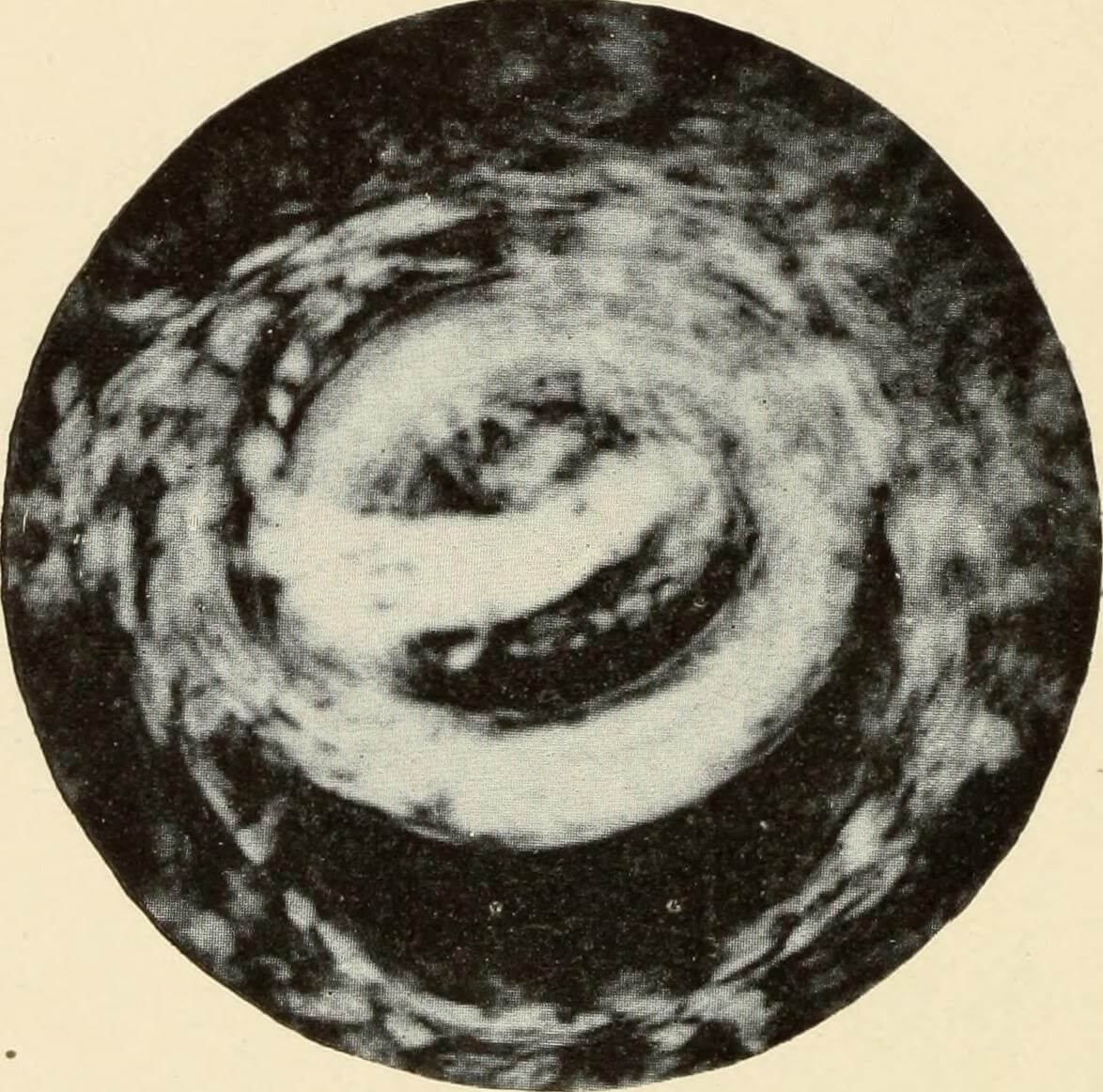 The Activity of the Larva of Nectoramericanus, Puerto Rico, 1911. Originally published in Bailey K. Ashford and Pedro Guitérrez Igaravidez's Uncinariasis (Hookworm disease) in Porto Rico: a medical and economic problem (Washington DC: US Government Print Office, 1911), 159. Photograph uploaded by Flickr user Internet Archive Book Images. Image is in public domain.
